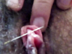 perforación de aguja de clítoris
