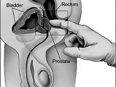 How To Milk Your Prostate By Yourself