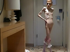 Anorexia Christin showcasing her Bones & Skinny Skeleton