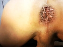 insertion masturbator anal