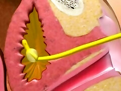 Female catheter insertion
