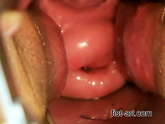 Triple cucumber - continued Triple cucumber - continued