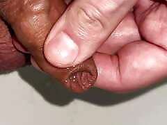 playing with foreskin while peeing playing with foreskin while peeing