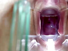 Stella St. Rose - Extreme Cervix Views and Juices Flowing Using a Speculum