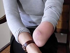 Arm Amputee putting on a watch