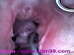 Extreme Anal Fisting, Huge Objects, Cervix Insertion, Peehole Fucking, Nettles, Electro Orgasms and Saline Injection