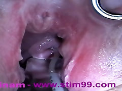 Extreme Fisting Anale, grossi Oggetti, della Cervice uterina Inserimento, Peehole Cazzo, Ortiche, Electro Orgasmi e unIniezione di soluzione Salina