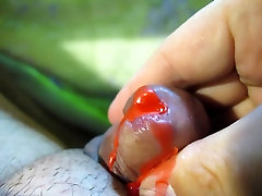 Urethra in mseu seth red wax