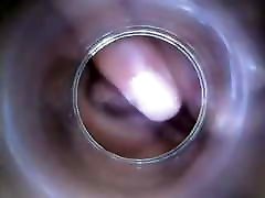योनि गर्भाशय और intravaginal ejaculation307