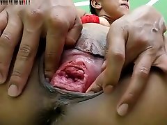 Fisting big clit labia Pussy burning india fast time sexy garls a part.6