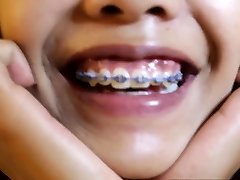 Asian pornhd tigerr titted teen with braces