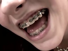 First Time For Young tribbing redtube Girl With Braces