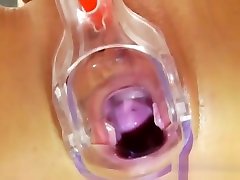 Medical Tool Shoved In Keiras Pussy