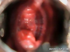 german sadia 44 ddd gets hairy pussy opened with speculum