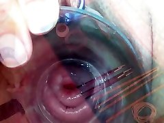 Extreme Cervix Playing with very skinny ass fuck Metal Chain in Uterus