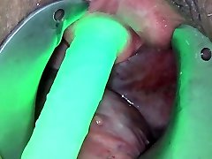 Endoscope Cam in Pee Hole with Semen and Sounding with Dildo