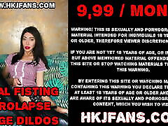 Huge XO speculum open to the max – sister geams hole of Hotkinkjo.