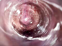 دوربین داخل بیدمشک خامه تنگ من, نمای داخلی از مهبل واژن