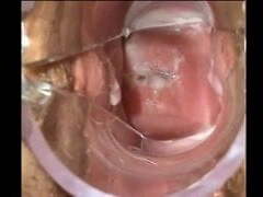 Speculum Cum
