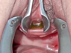 piss hole fucking with toothbrush and insertion of lengthy metal chain into her bladder