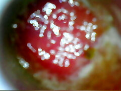 USB endoscope 80 cm deep anal injection