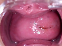 لاسی, چک, سکس امتداد او باریک, به specia