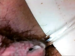 Endoscope trip inside my pee