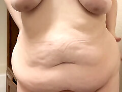 i dunno if u can treat all this~