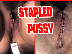 Sadistic doctor closes and staples his patient&039;s pussy