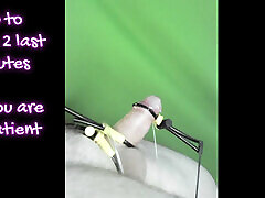 Triphase Eruption Triphase Eruption