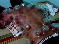 action from - Cupping