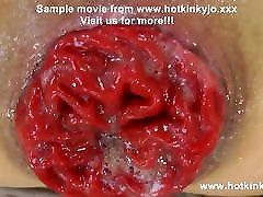 Hotkinkyjo anal Dragon chinese foot licking from mrhankey & prolapse